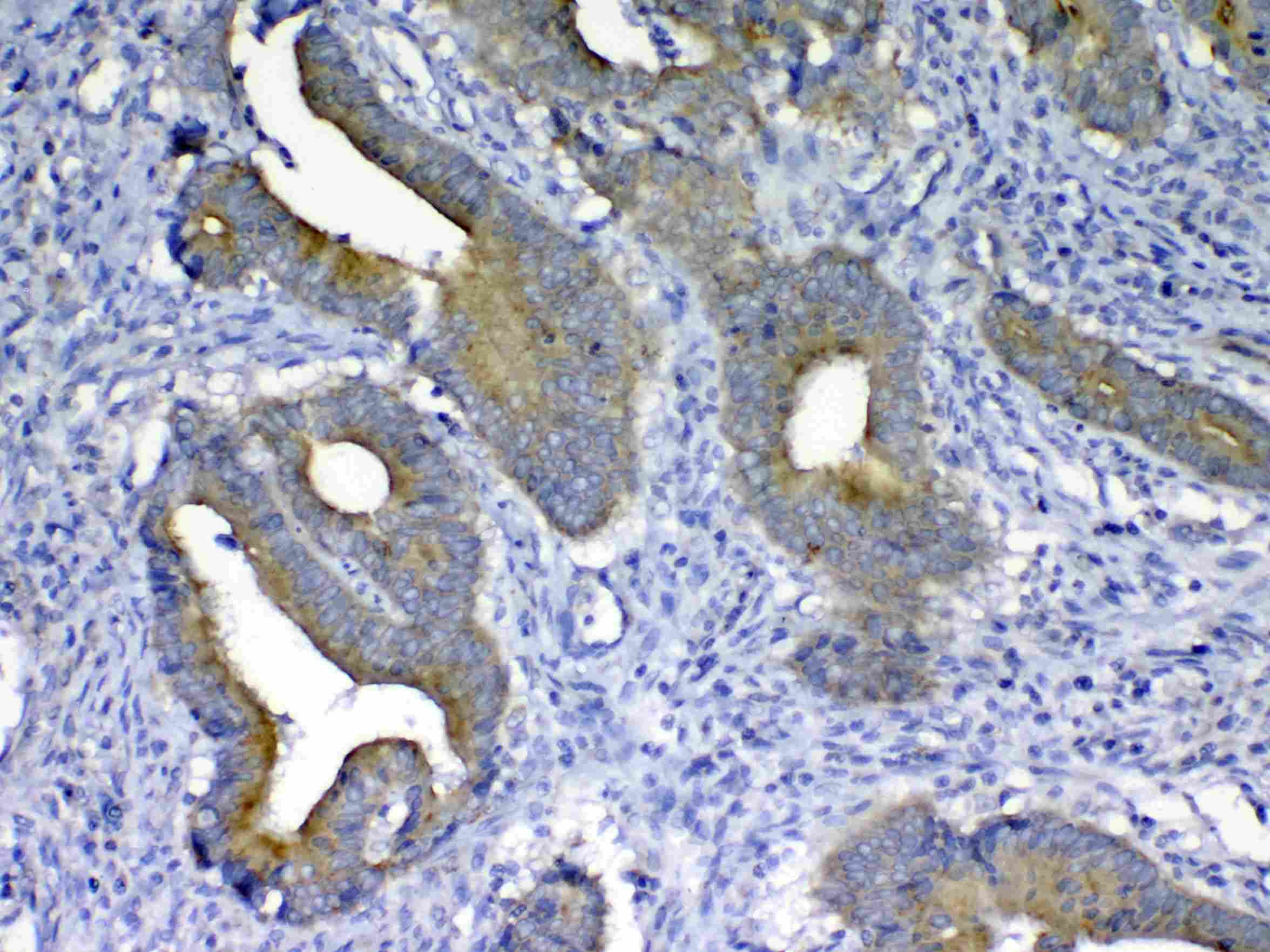 MMP10 Antibody