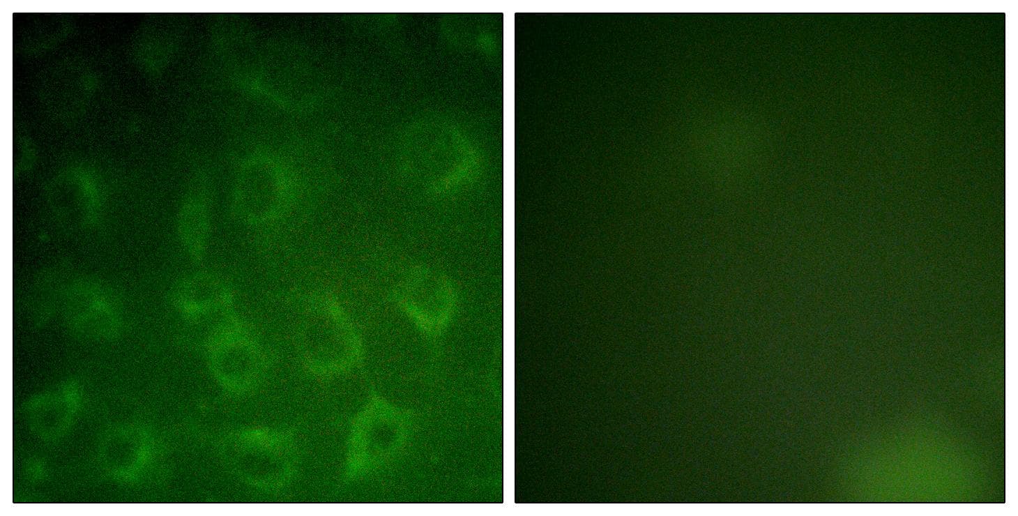 PDGFRB / PDGFR Beta Antibody (p1021)