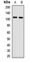 TRPC6 Antibody