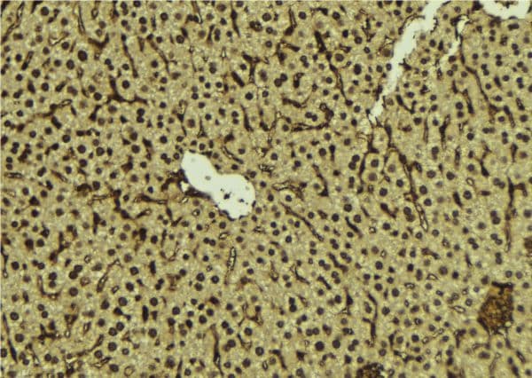 Polyclonal Rabbit anti-Human FANCC Antibody (IHC, WB)