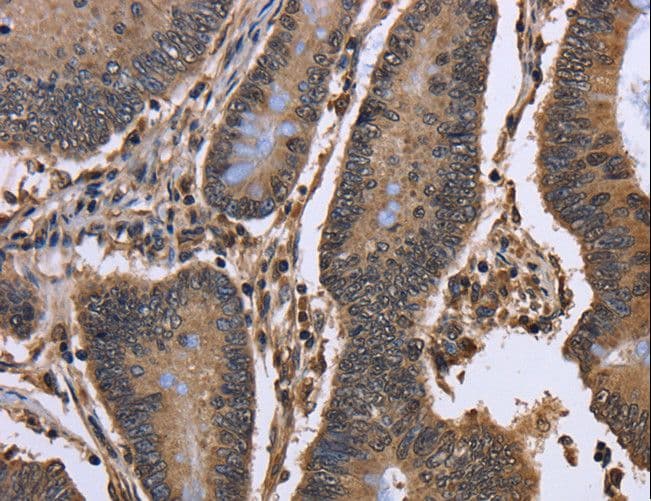 SMIF / DCP1A Antibody