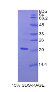 Rat MGST1 Protein (Recombinant His, N-Terminal)