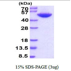 Human BHMT Protein (Recombinant His)