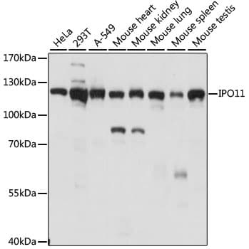 Polyclonal Rabbit anti-Human IPO11 / Importin 11 Antibody (WB)