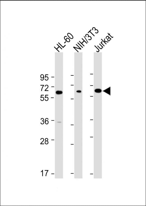 Monoclonal Mouse anti-Human ME2 / Malate Dehydrogenase 2 Antibody (clone 970CT2.1.1.2, C-Terminus, IHC, WB)