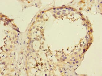 Polyclonal Rabbit anti-Human ATXN10 / SCA10 Antibody (IHC, WB)