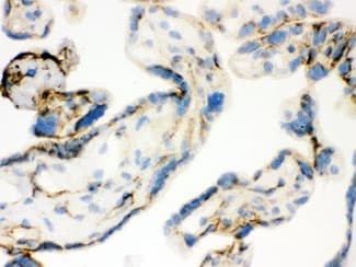 TGM2 / Transglutaminase 2 Antibody