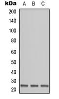 Polyclonal Rabbit anti-Human OAZ1 / OAZ Antibody (N-Terminus, IHC, WB)