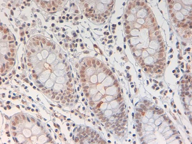 STAT3 Antibody (phospho-Tyr705)