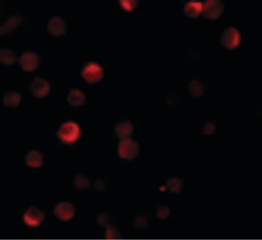 Polyclonal Rabbit anti-Human PARP13 / ZC3HAV1 Antibody (IF, WB)