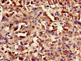 ASH1L / ASH1 Antibody