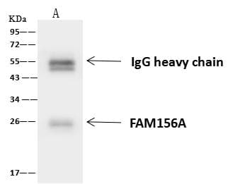 Polyclonal Rabbit anti-Human FAM156A / TMEM29 Antibody (WB)