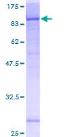 Human KATNB1 Protein (Recombinant GST)