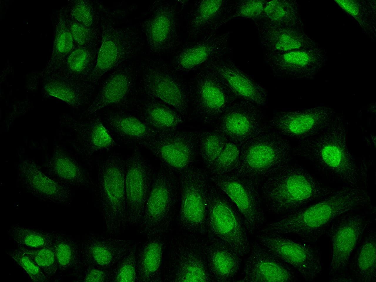 SUPT16H / FACTP140 Antibody