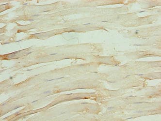 Polyclonal Rabbit anti-Human OSBPL6 Antibody (IHC)