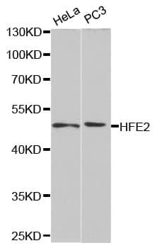 HFE2 / Hemojuvelin Antibody