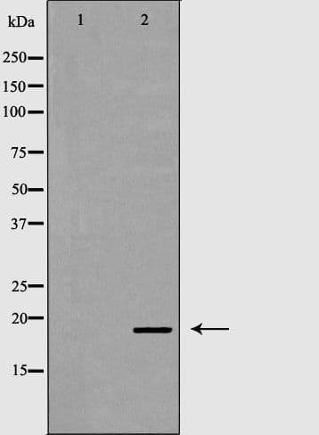 VIP Antibody