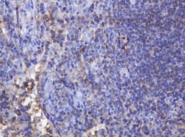 FNDC4 Antibody (clone OTI1B7)