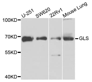 PathPlus™ GLS / Glutaminase Antibody