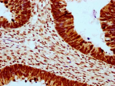 Polyclonal Rabbit anti-Human HIST1H2BN Antibody (IHC, IF)
