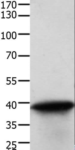 TPM2 Antibody