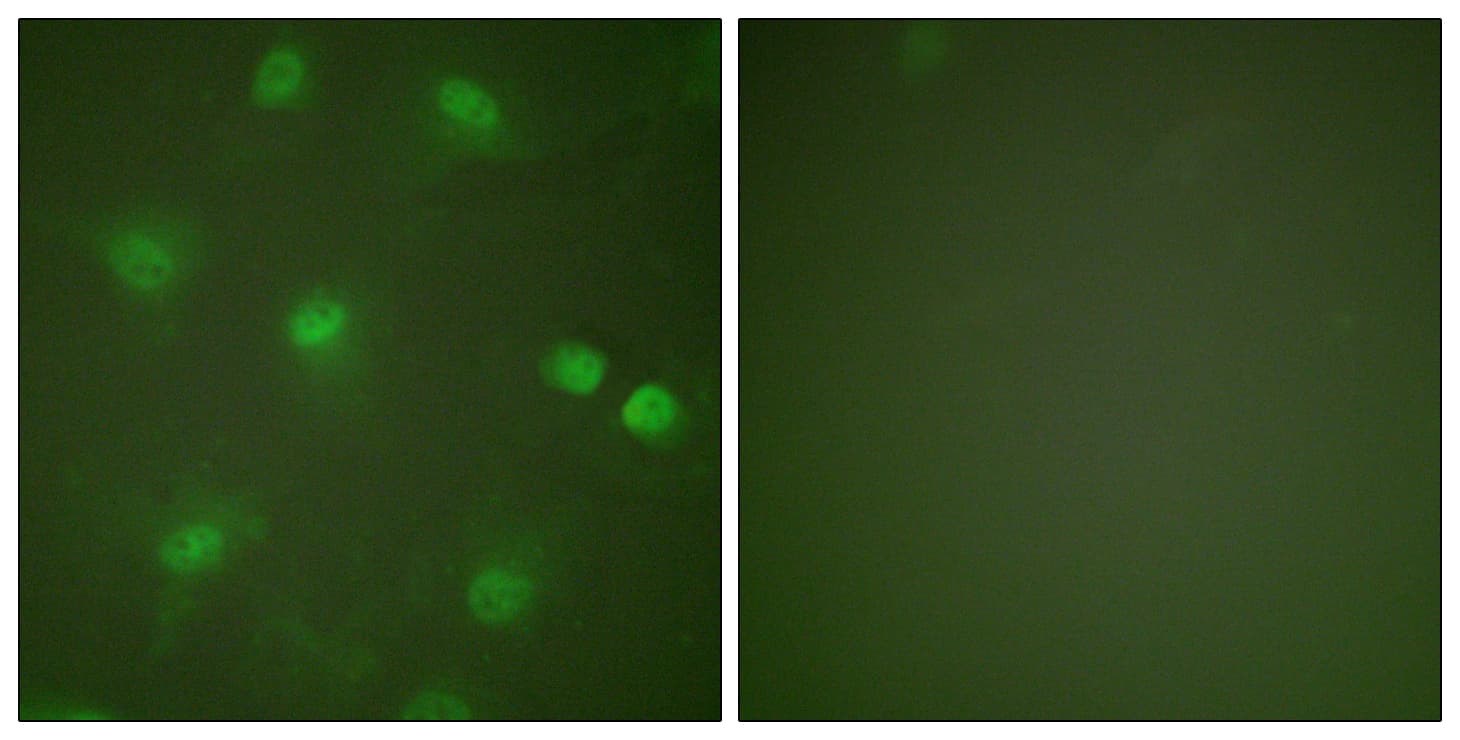 IHC-plus™ MEF2A / MEF2 Antibody (aa374-423)