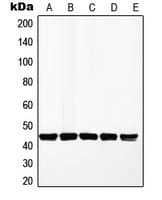 MAP2K1 / MKK1 / MEK1 Antibody (Internal)