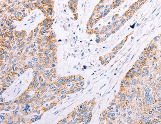 Polyclonal Rabbit anti-Human GFRA3 Antibody (IHC)
