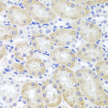 Polyclonal Rabbit anti-Human Adiponectin Antibody (IHC, WB)