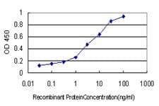 IHC-plus™ Monoclonal Mouse anti-Human HSPB7 / CvHSP Antibody (clone 3E11, IHC, WB)