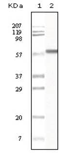 KRT1 / CK1 / Cytokeratin 1 Antibody (clone 3C10F7, 3C10G5)