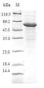 Human CFDP1 Protein (Recombinant GST, N-terminus)