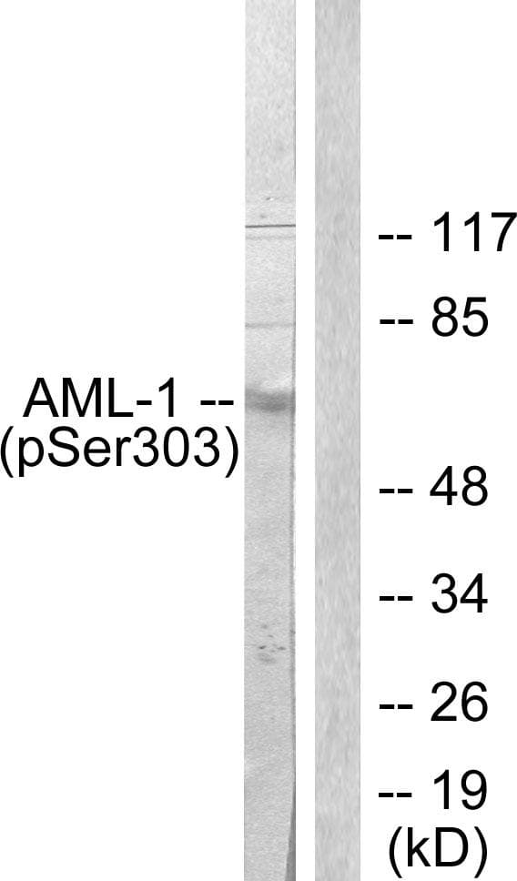 AML1 / RUNX1 Antibody (phospho-Ser303)