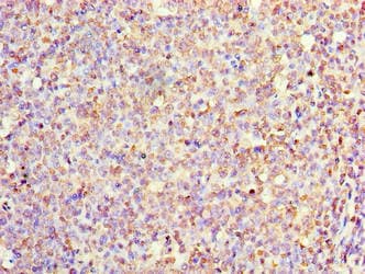 IL1F10 Antibody (aa1-152)