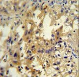 Polyclonal Rabbit anti-Human UP2 / UPP2 Antibody (aa217-244, IHC, WB)