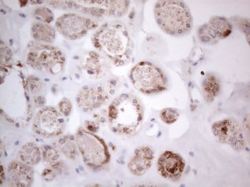 Monoclonal Mouse anti-Human RORB / ROR Beta Antibody (clone OTI1G1, aa1-260, IHC, WB)