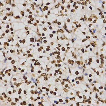 Polyclonal Rabbit anti-Human Histone H4 Antibody (Tri-Methyl-Lys20, IHC, IF, WB)