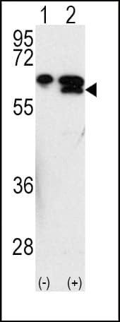 MMP3 Antibody (aa298-327)