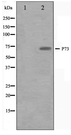 TP73 / p73 Antibody