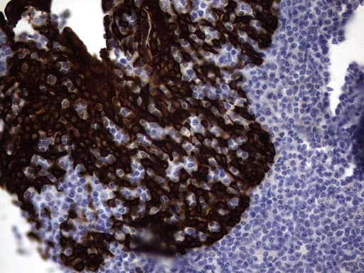 KRT19 / CK19 / Cytokeratin 19 Antibody (aa240-390, clone OTI7H7)