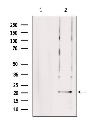 Polyclonal Rabbit anti-Human TRAPPC5 Antibody (IHC, WB)
