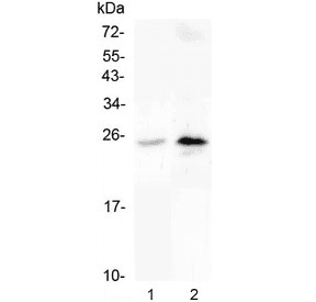 Polyclonal Rabbit anti-Human CRP / C-Reactive Protein Antibody (IHC, WB)