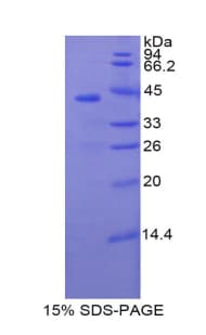 Pig SELE / CD62E / E-selectin Protein (Recombinant His-GST)
