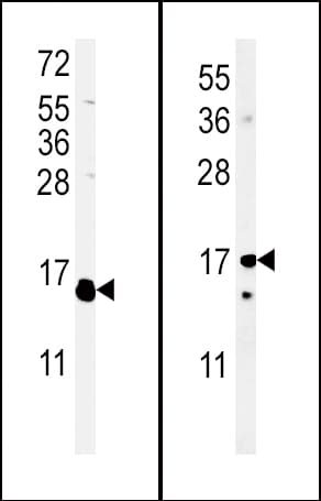 Polyclonal Rabbit anti-Human IL4 Antibody (aa122-150, IHC, WB)