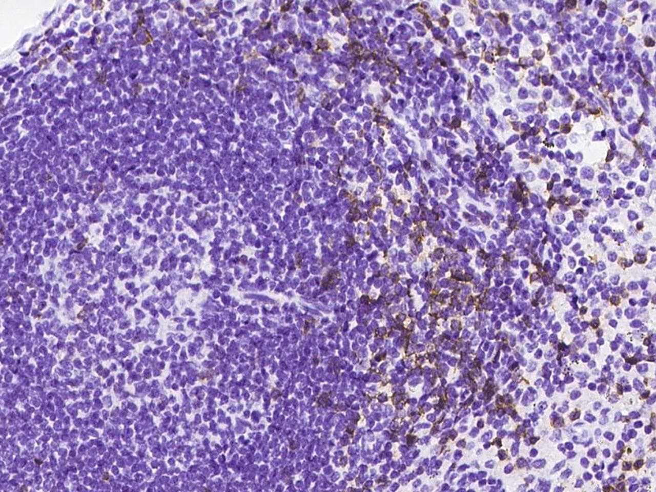 CD8A / CD8 Alpha Antibody (Preservative Free)
