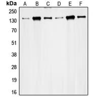 Polyclonal Rabbit anti-Human RAD50 Antibody (Internal, IHC, WB)