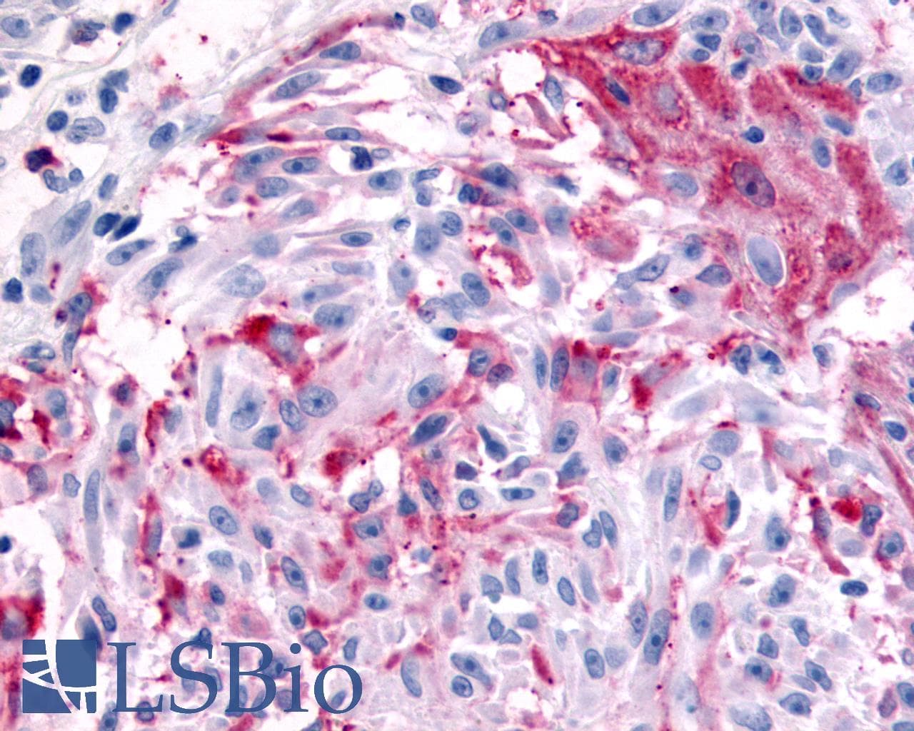 PathPlus™ MRGPRX4 / MRGX4 Antibody (C-Terminus)