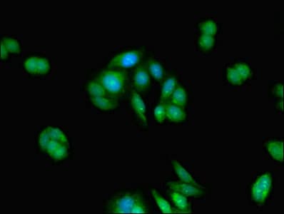 Polyclonal Rabbit anti-Human TMEM67 Antibody