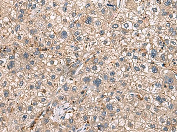 HLA-DRA Antibody