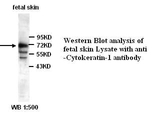 KRT1 / CK1 / Cytokeratin 1 Antibody (Internal)